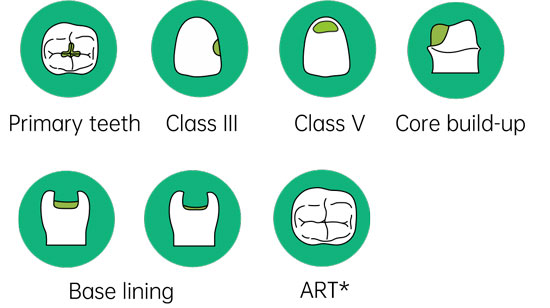 dental cement glass ionomer