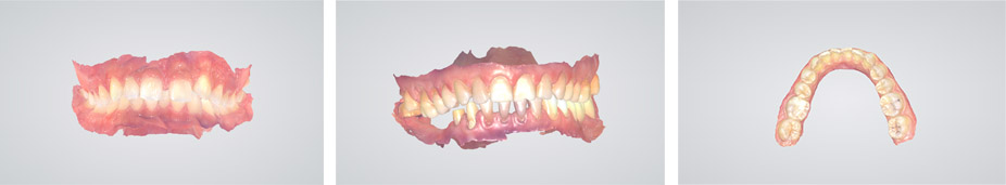 Cases of Scanning