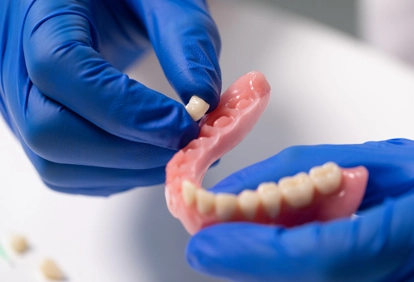 artificial teeth material