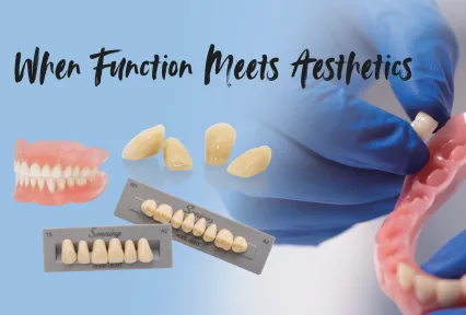 HUGE SENIORS & SONNING Teeth - Creating Stability for Full Dentures